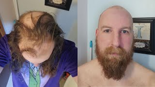 LONG HAIR To BALD in 20 Seconds TRANSFORMATION [upl. by Lletnahc]