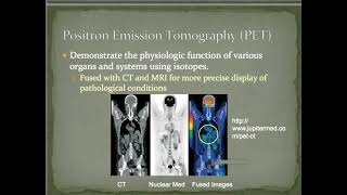 MRI explained How does it work [upl. by Erreip]