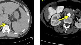 Introduction to Radiology Conventional Radiography [upl. by Qulllon]