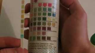 How to perform Urinalysis [upl. by Atinrev]