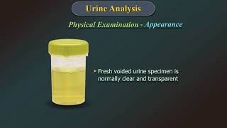 Urine Analysis [upl. by Yffub]