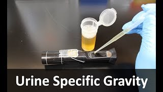 Urine Specific Gravity Refractometer [upl. by Anneirda]