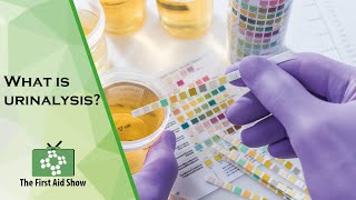 What is urinalysis [upl. by Spada]