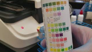 Urinalysis Performing QC on the Criterion II [upl. by Caesaria]