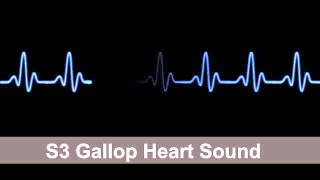 S3 Gallop Heart Sound Collection For Auscultation Skills [upl. by Hevak]